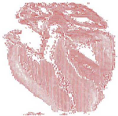 Cardiac Re-entry Dynamics and Self-termination in DT-MRI Based Model of Human Fetal Heart